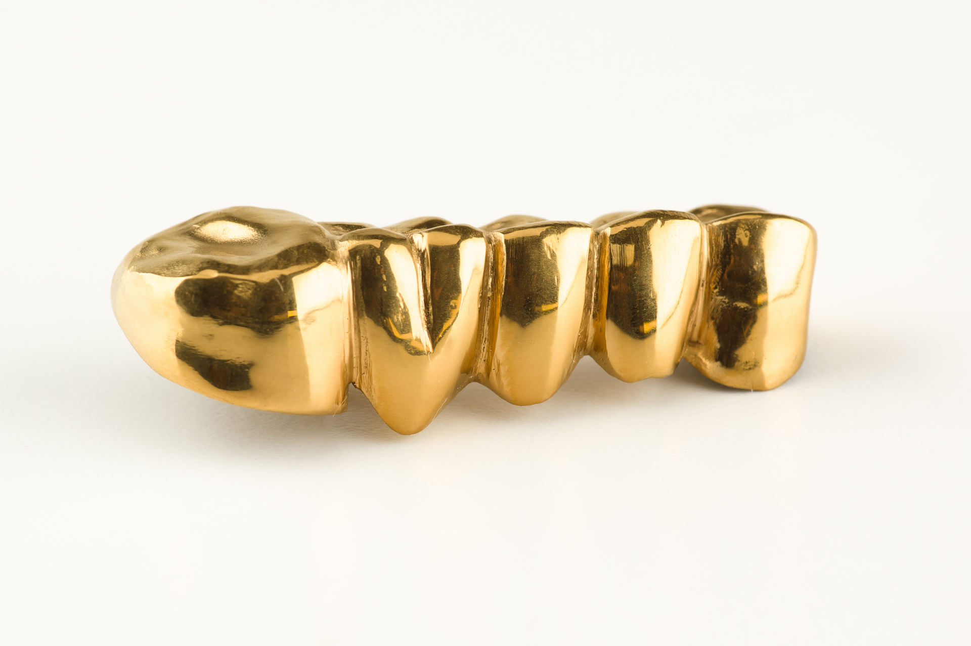 Gold dental bridge on a white surface, with five connected teeth.