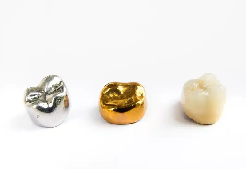 Three dental crowns: silver, gold, and tooth-colored, arranged on a white surface.