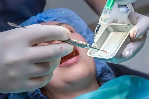 Dentist examining a patient’s mouth with dental tools and mirror in a clinic