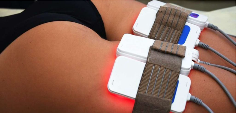 lipolaser cuisses
