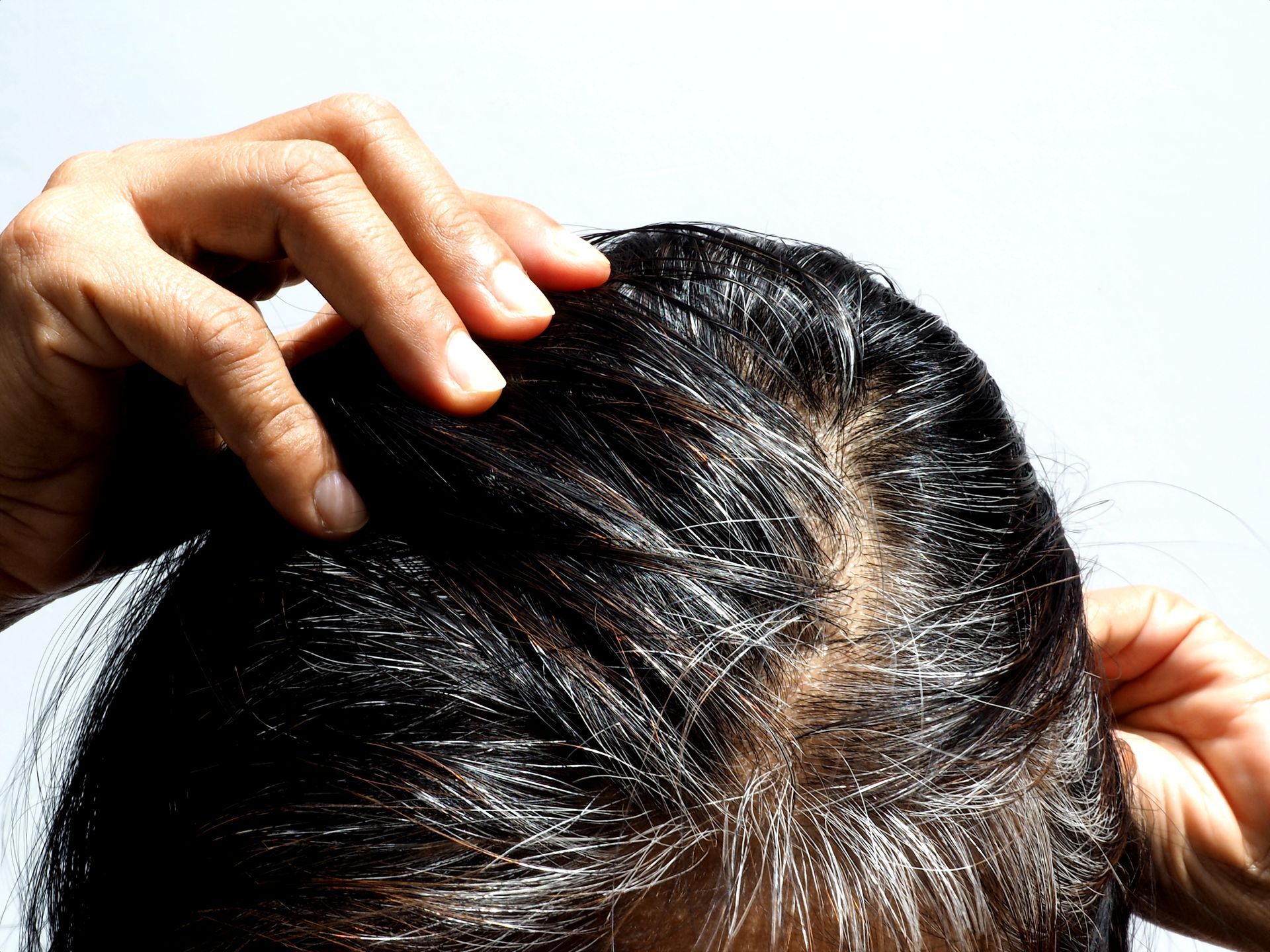 A woman showing white hairs
