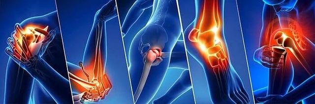 TRAUMATOLOGÍA Y ORTOPEDIA DR FRANCISCO CORREA - FRACTURAS