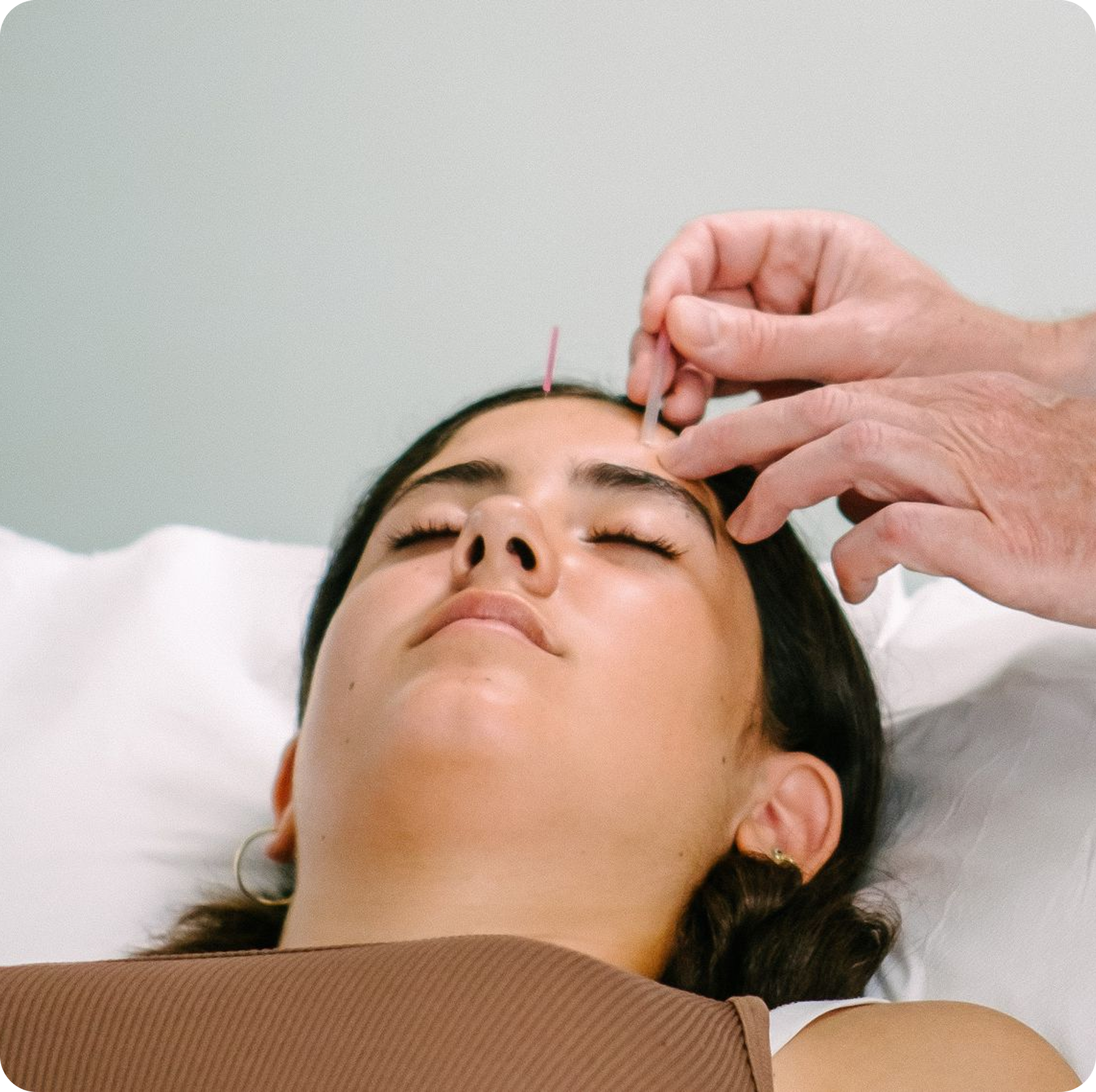 A female acupuncture patient, deeply relaxed on the couch, with an acupuncturist placing a needle on her forehead.