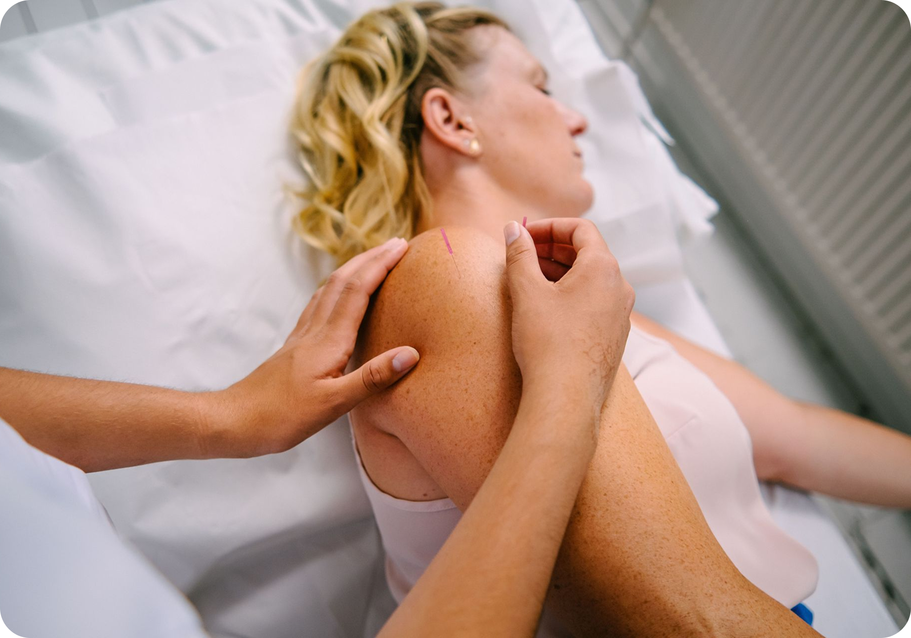 A patient is lying on her side, with an acupuncturist, who is needling her shoulder to help relieve pain.