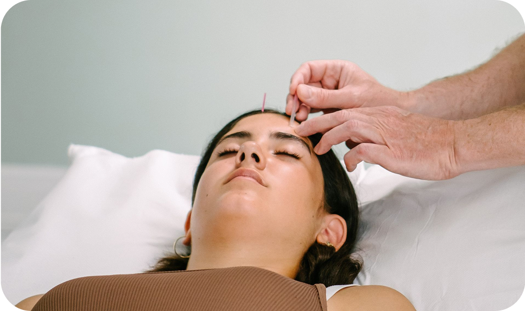 A female acupuncture patient, deeply relaxed on the couch, with an acupuncturist placing a needle on her forehead.