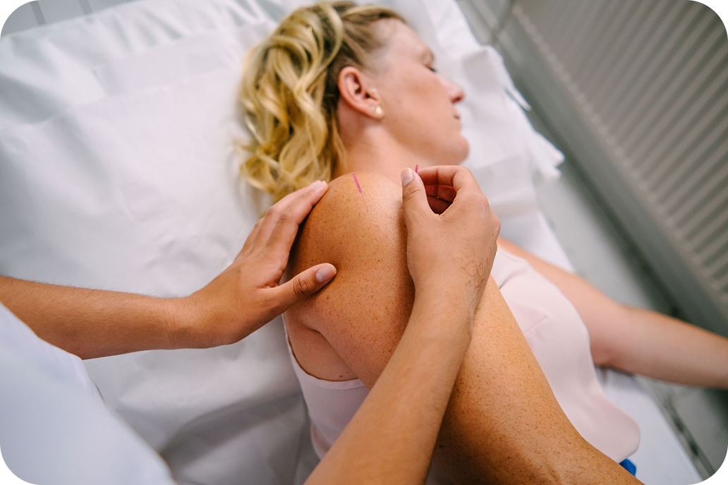 A patient is lying on her side, with an acupuncturist, who is needling her shoulder to help relieve pain.