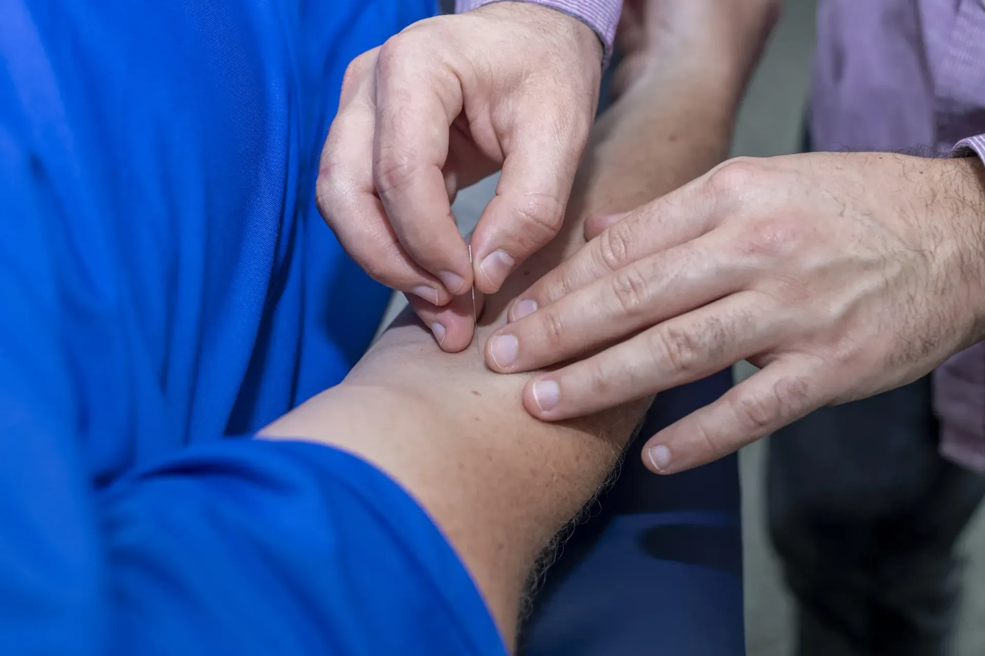 A close-up of an acupuncturist palpating a patient's elbow whilst finding an acupuncture point called Large Intestine 11.