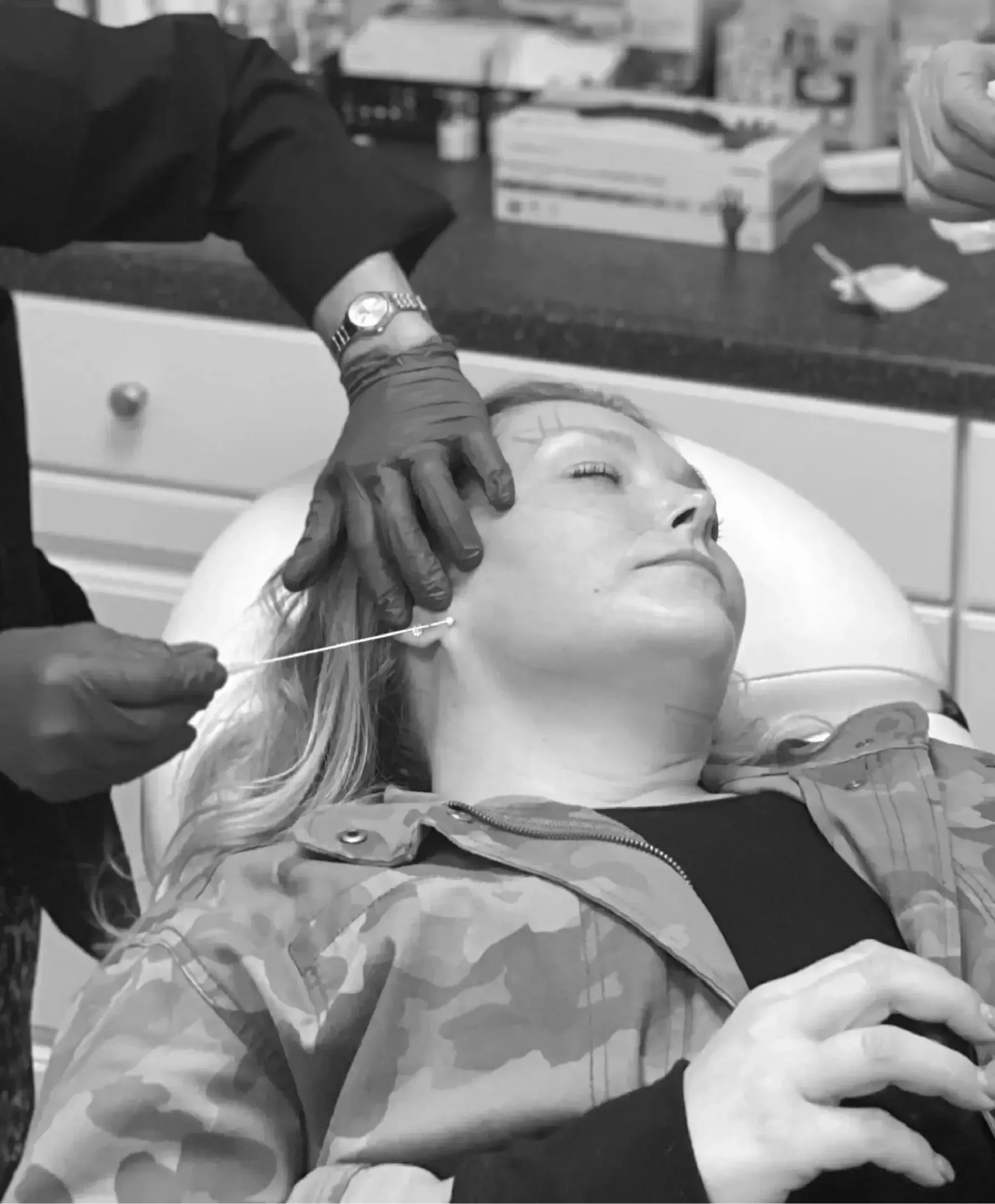 PDO Thread Lift and Skin Tightening Treatment PDO Thread Treatment at Rejuvn8