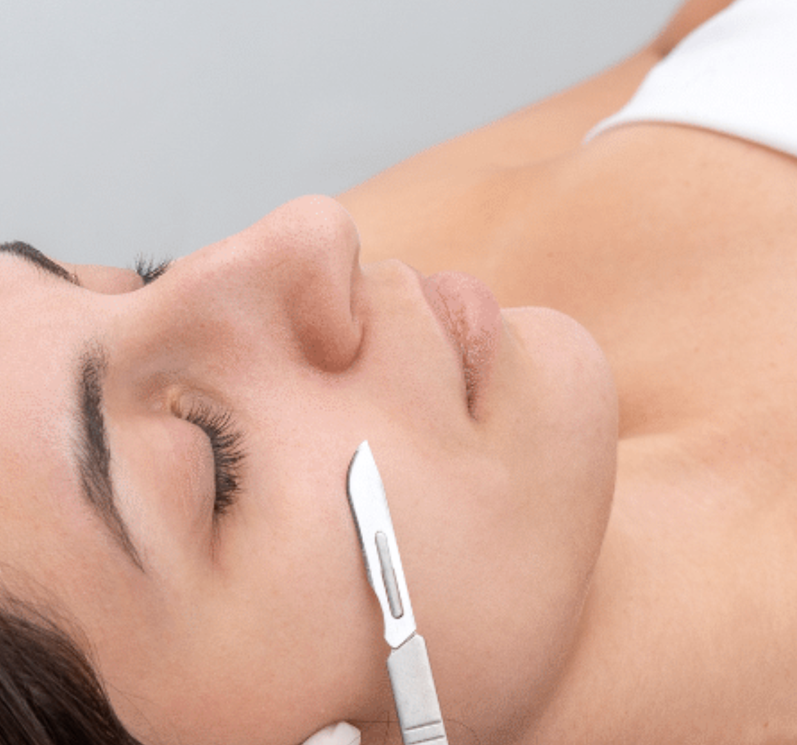 Dermaplanning treatment
