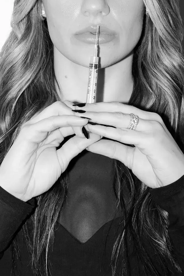 Lip fillers in Syracuse, New Hartford, and Albany, NY