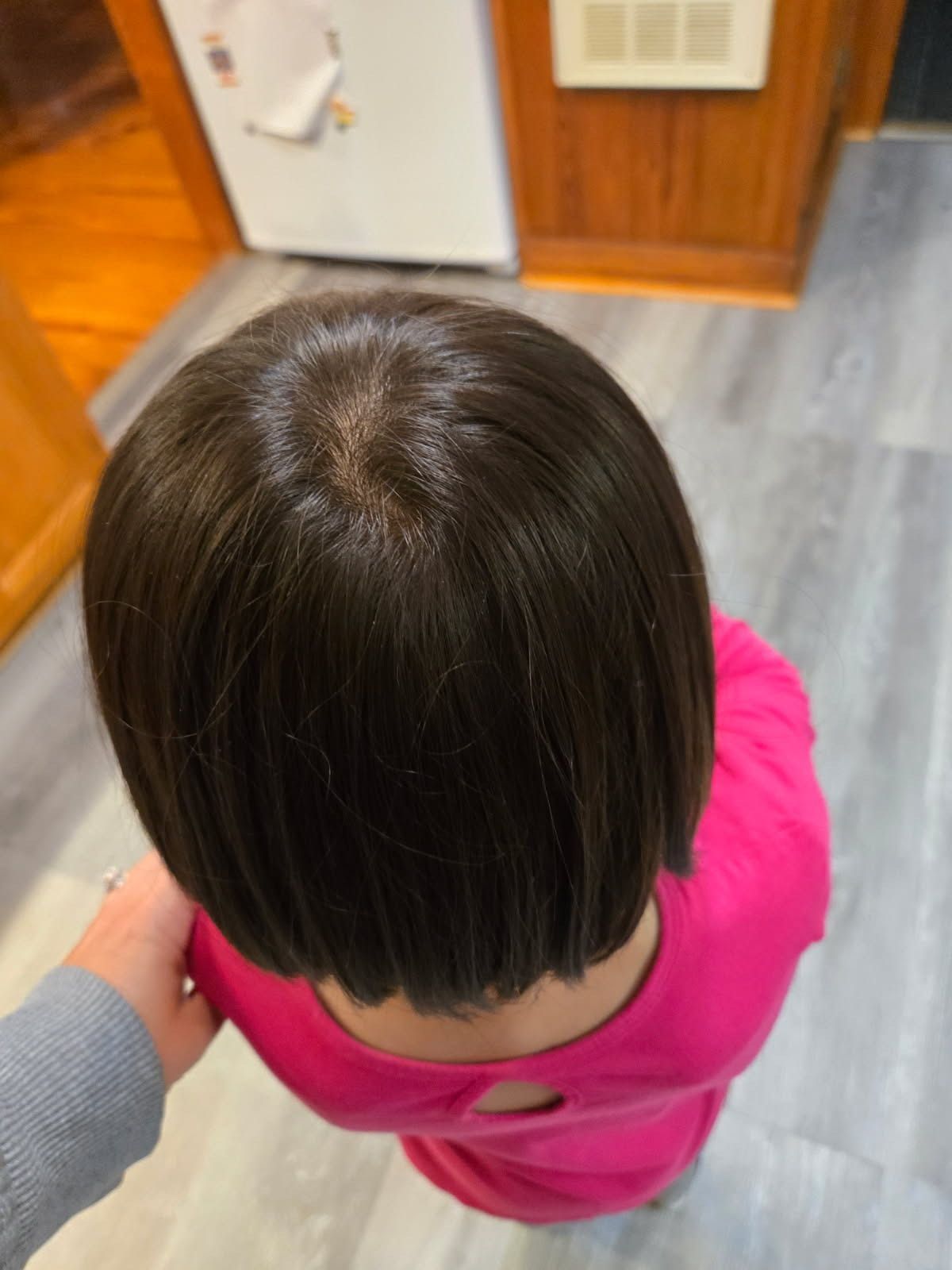 Full Hair Restoration