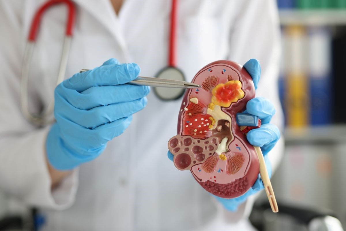 colica-renal-causas-dr-antonio-rocha-junior-urologista-teresina-piaui