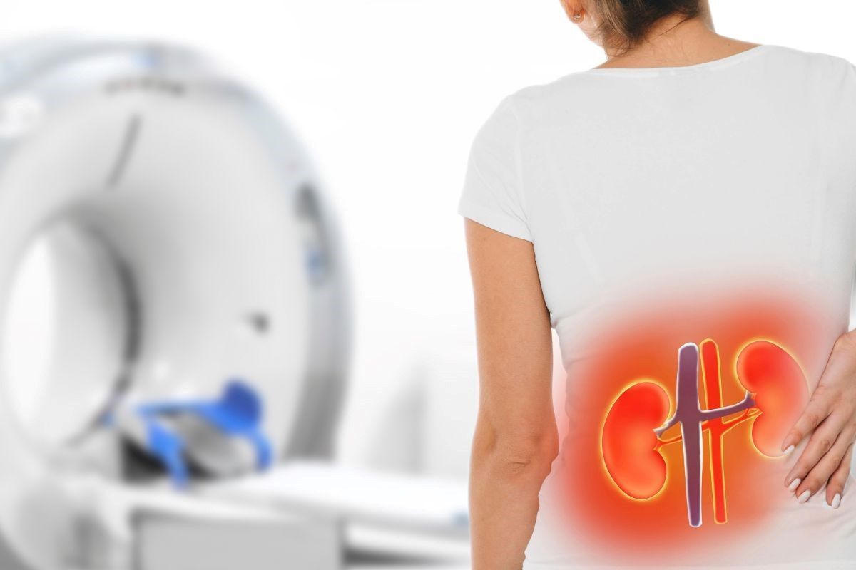 colica-renal-tratamento-dr-antonio-rocha-junior-urologista-teresina-piaui