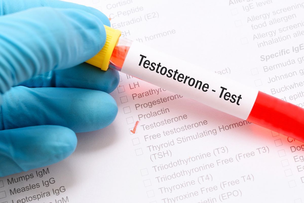 testosterona-baixa-diagnostico-dr-antonio-rocha-junior-urologista-teresina-piaui