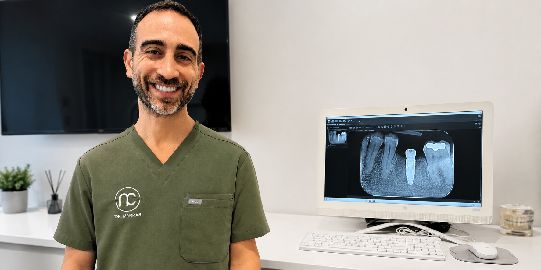 Quanto durano gli impianti dentali