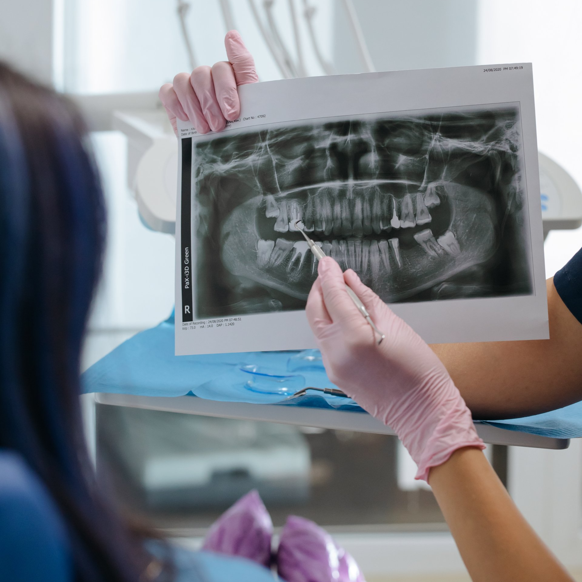 Advanced Periodontics of Lehighton, LANAP, laser assisted new attachment procedure