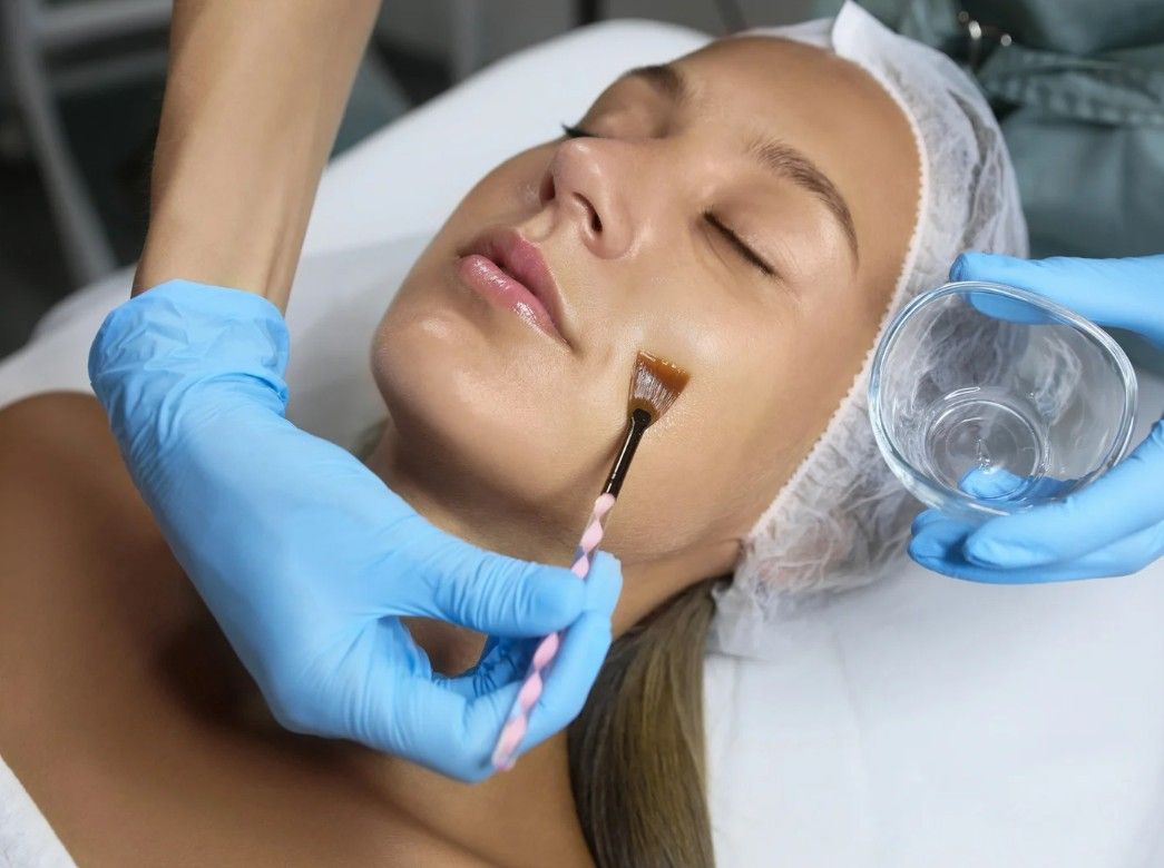The Skin Studio applying glycolic peel to a client's face in Nottingham