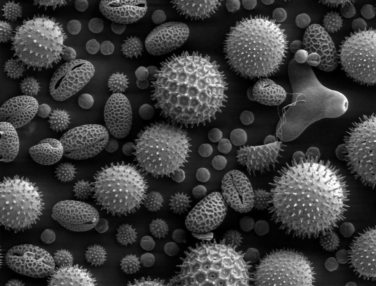 A black and white photo of pollen grains under a microscope.