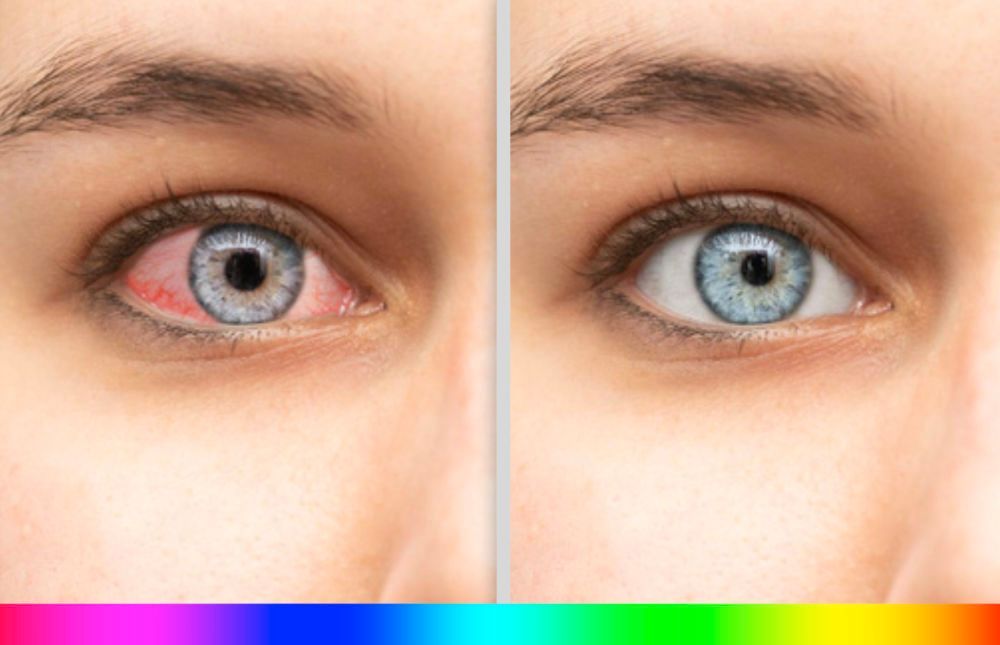Comprehensive Eye Exams