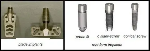 A picture of a blade implant and a picture of a root form implant