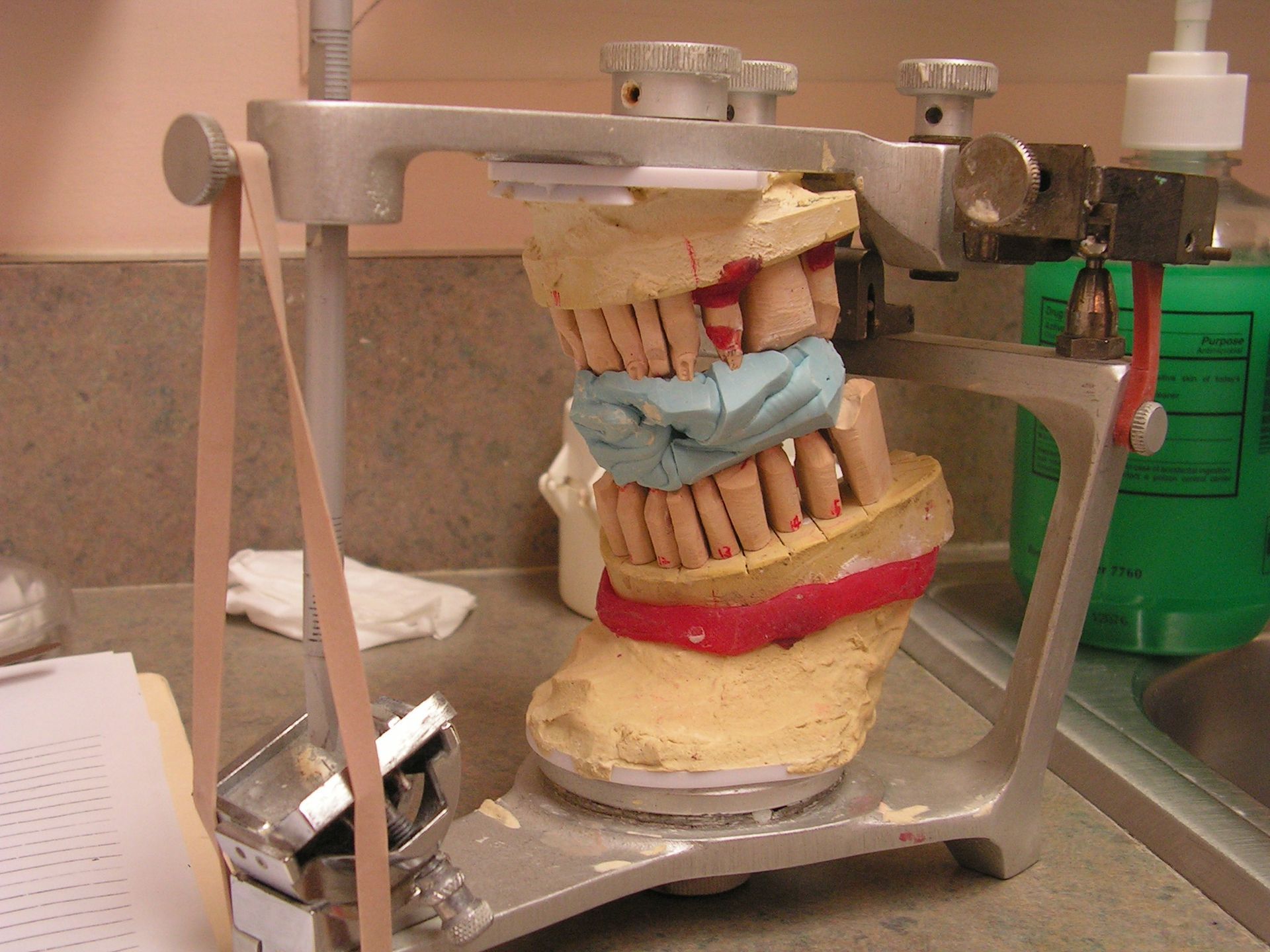 implants, dental implant reconstruction, full mouth reconstruction, top implant dentist 33578