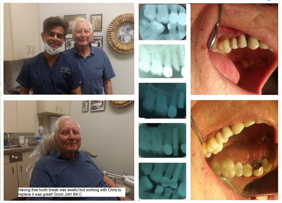 happy patient with premolar implant