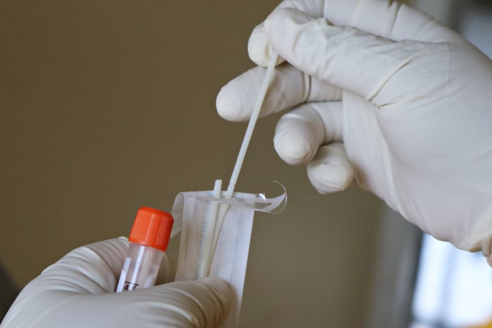 Cotton Swabs Sample — Rapid Antigen Testing Kits in South Mackay, QLD