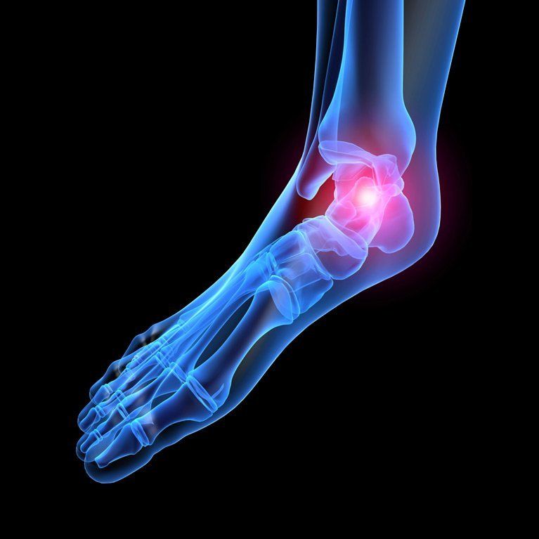 Gosford-Podiatry-xray