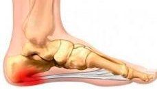 Illustration showing foot pain area