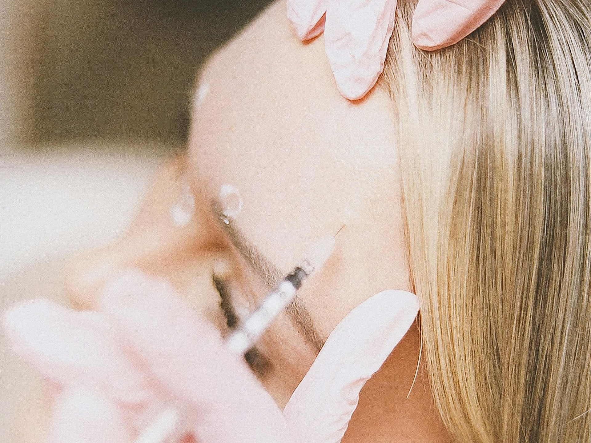 Botox image