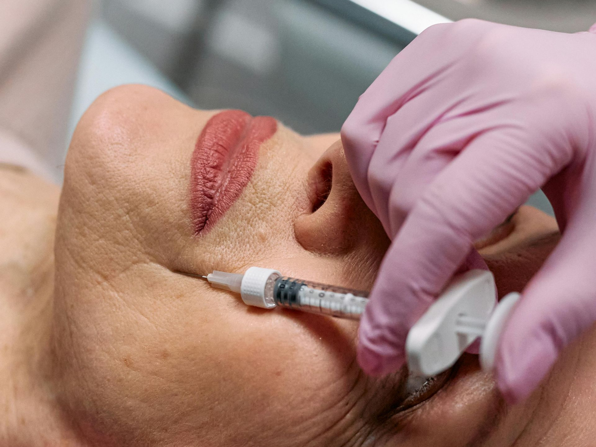 Dermal filler image