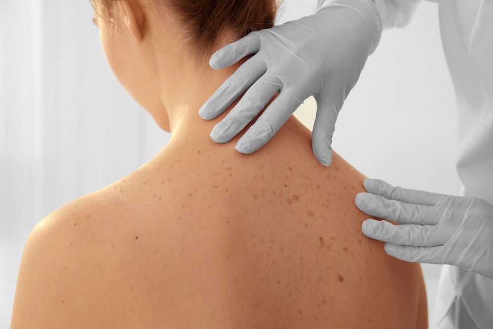 A Woman is Getting Her Skin Examined by a Doctor — Coastal Skin & Laser in Coolum, QLD