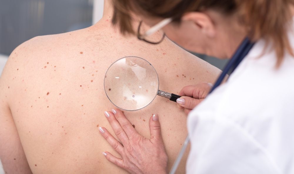 A Doctor is Examining a Patient Back With a Magnifying Glass — Coastal Skin & Laser in Maroochydore, QLD