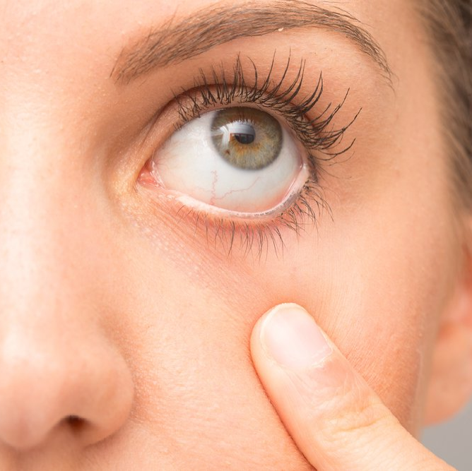 Person holding their finger on cheek below left eye