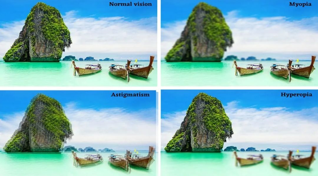 4 examples of boats in water when viewed with Normal, Myopia, Hyperopia, & Astigmatism vision