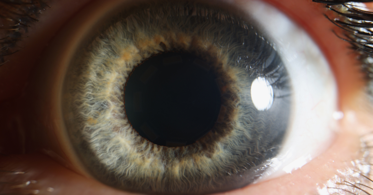 A close up of a person 's eye with a large dark pupil.