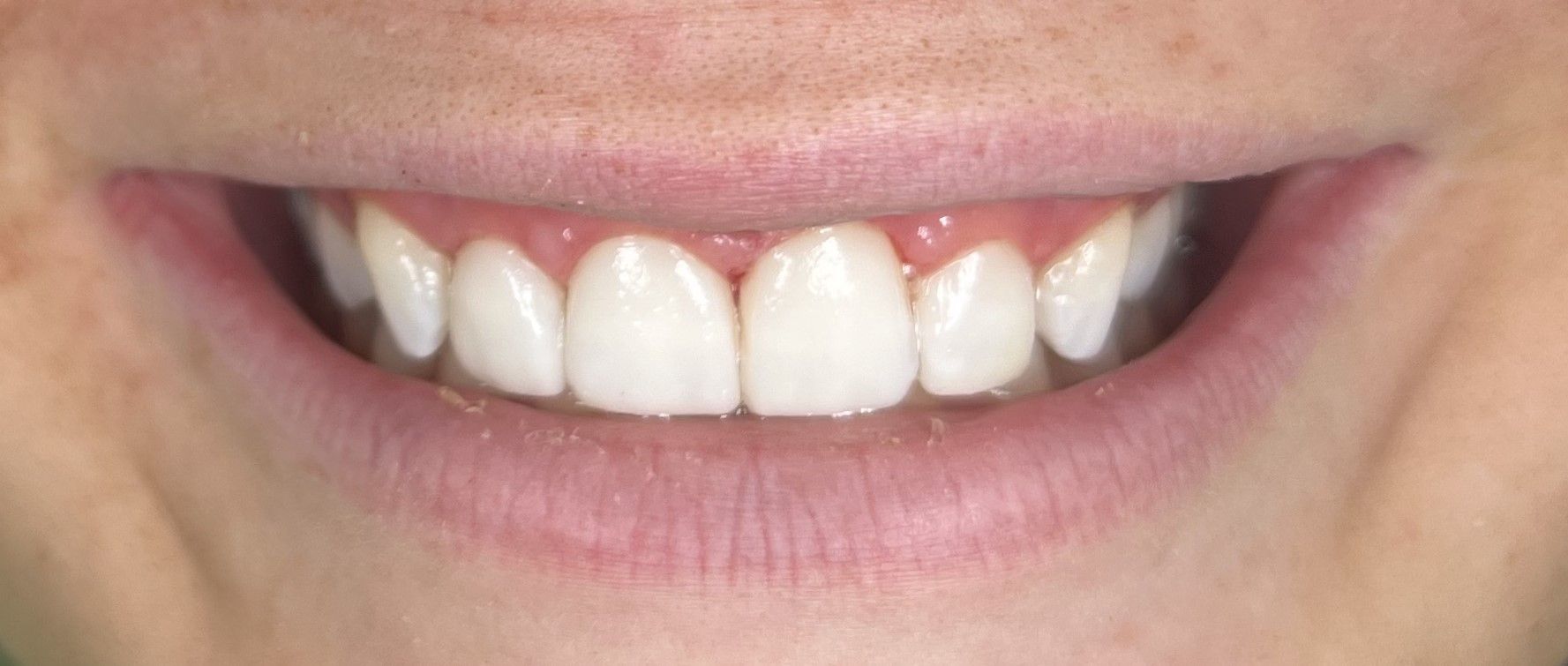 After Image 1