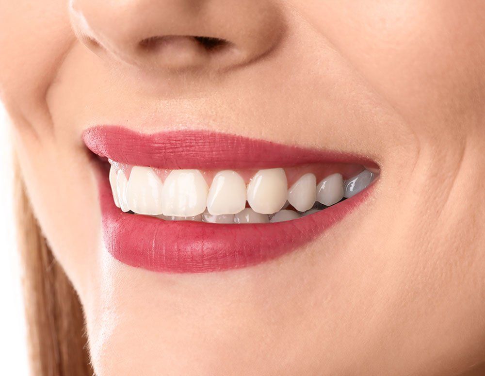 Close-up of a person with white teeth smiling