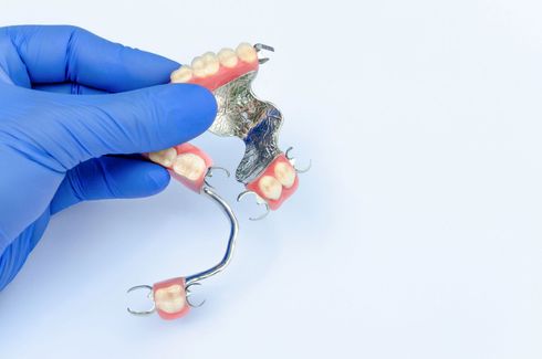 Mano guantata che regge una protesi parziale con gengive rosa, denti artificiali e fermagli metallici, su sfondo bianco.