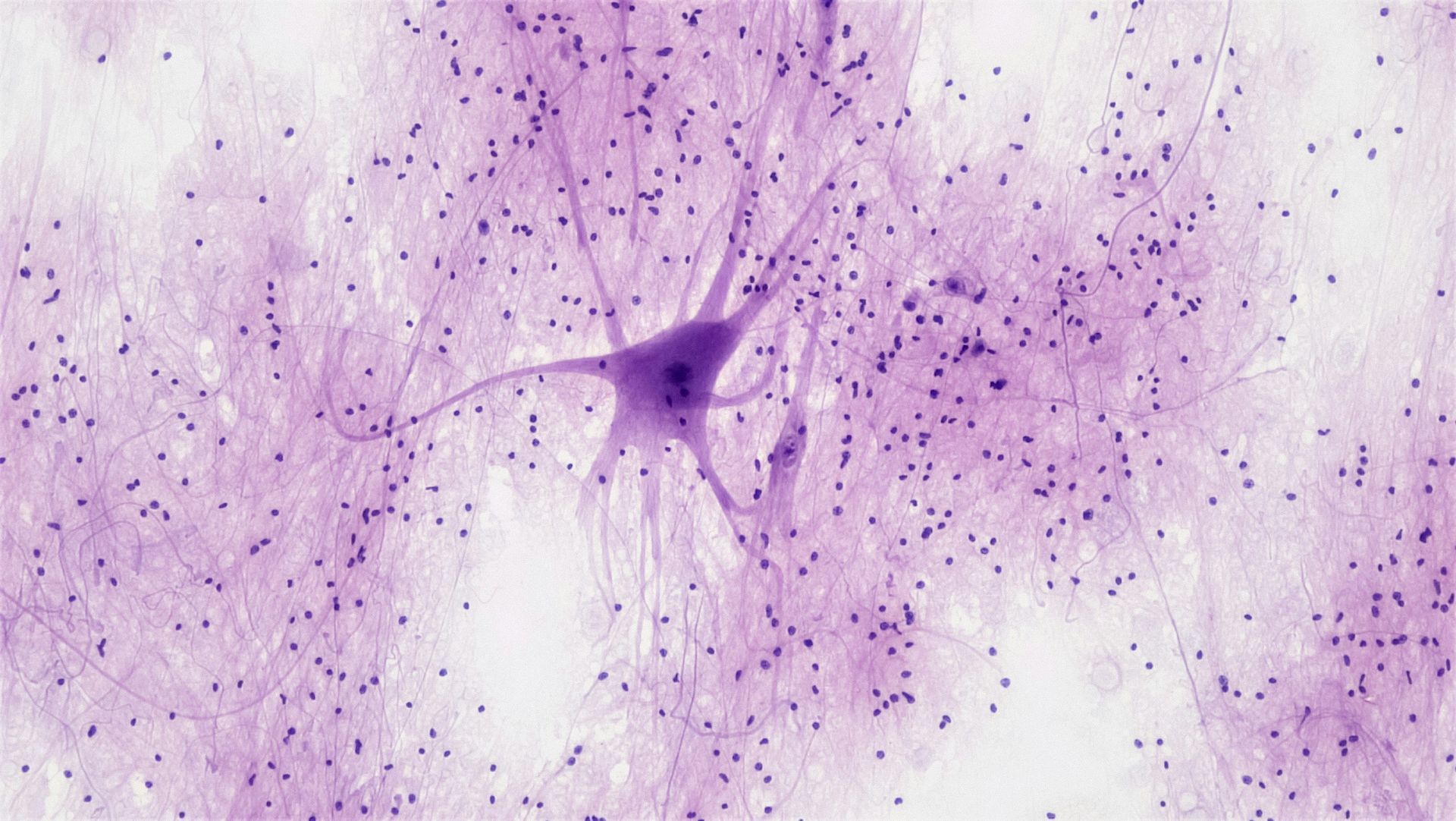 Purple-tinted microscopic image of a neuron with branching extensions and scattered dark-stained cells