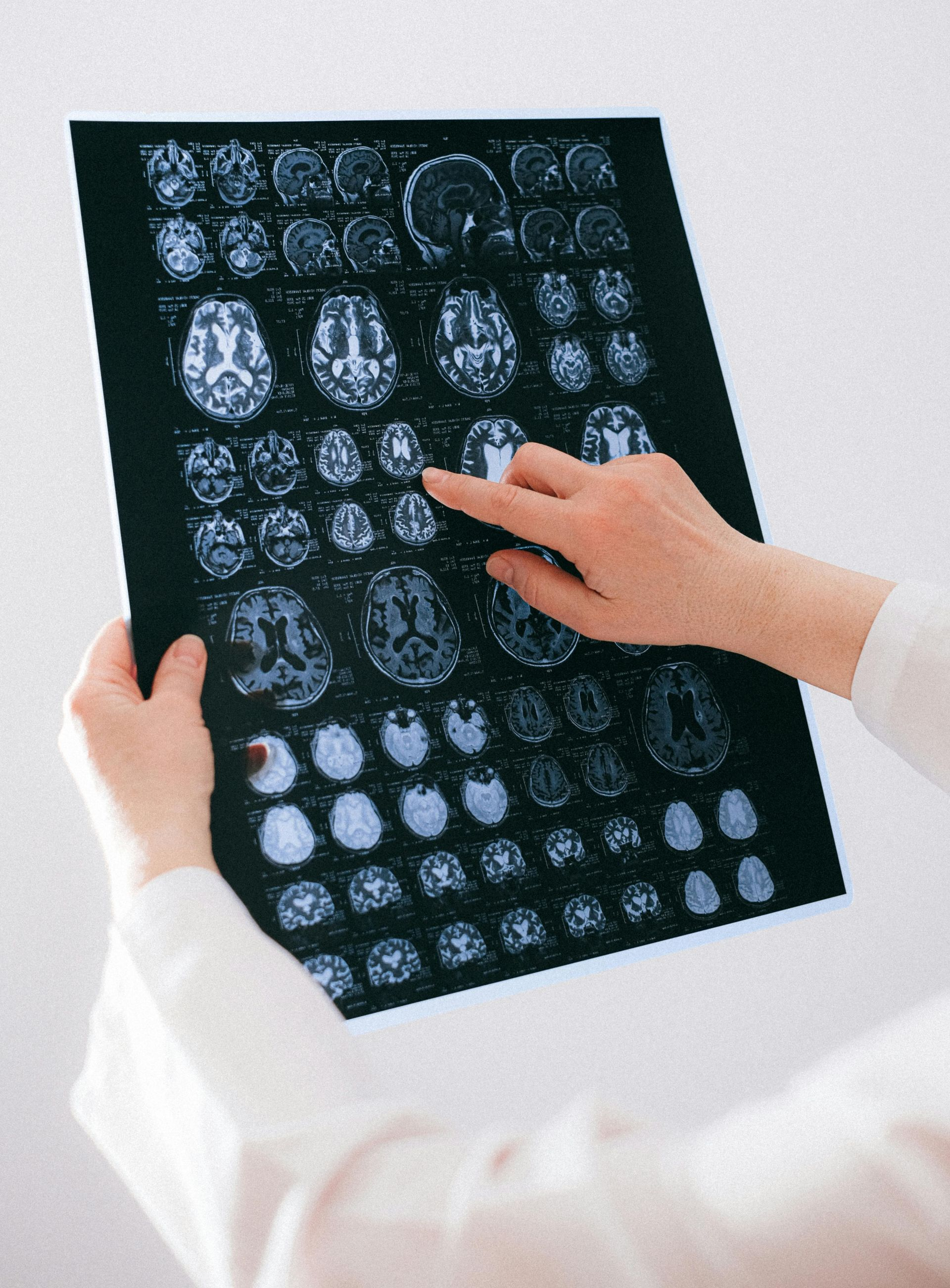 Hands pointing at a brain scan film sheet against a light background