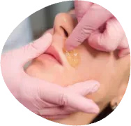 Gloved hands applying yellow gel to a patient's nose during a facial procedure