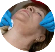 Gloved hands wiping a woman’s neck with gauze during a cosmetic treatment