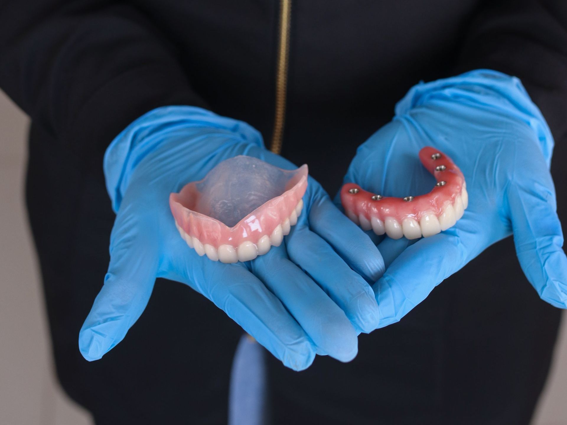 Dental Implants | Hybrid | Best family dentist near Alexandria VA 