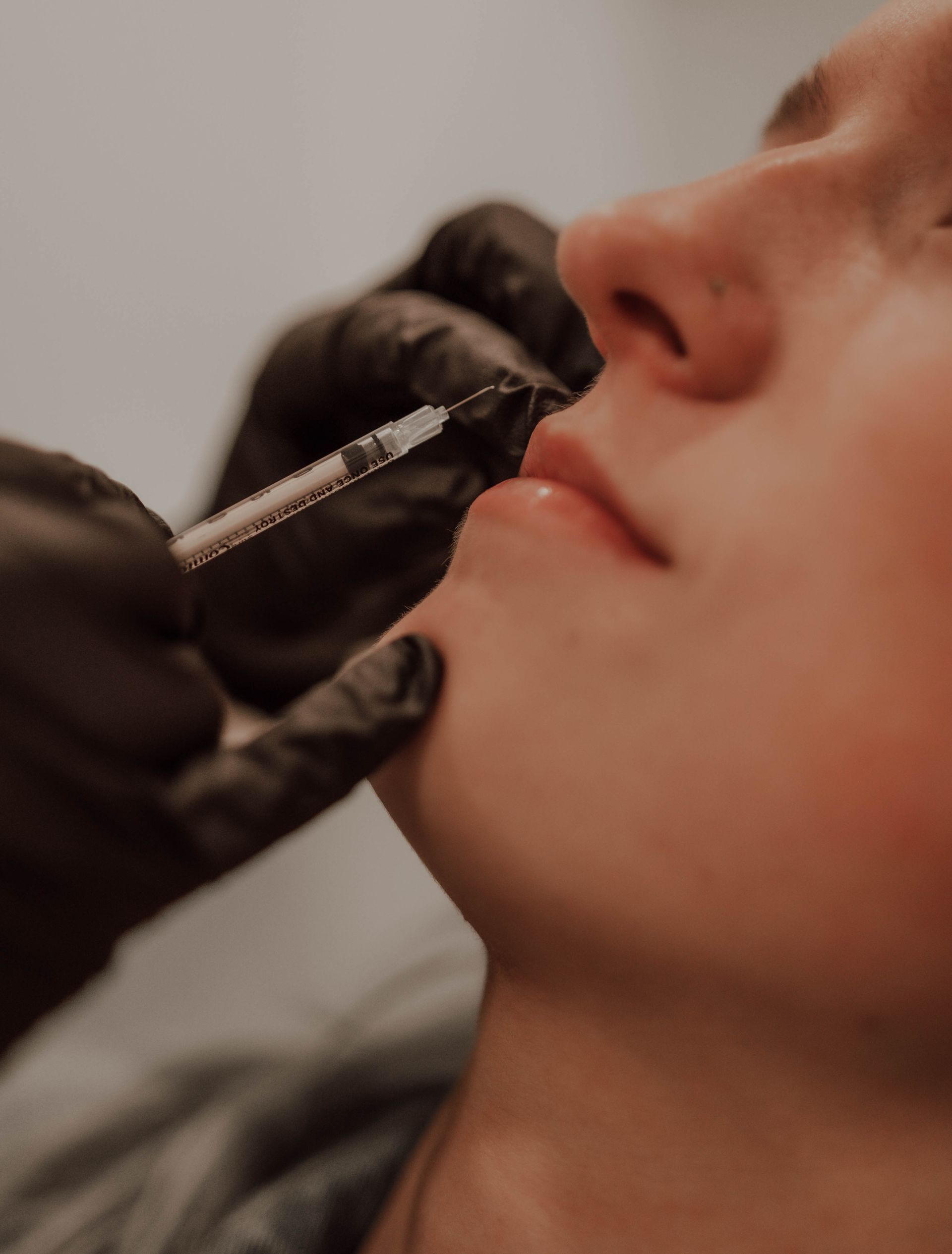 A person receiving a lip injection. A gloved hand injects the lip with a syringe.