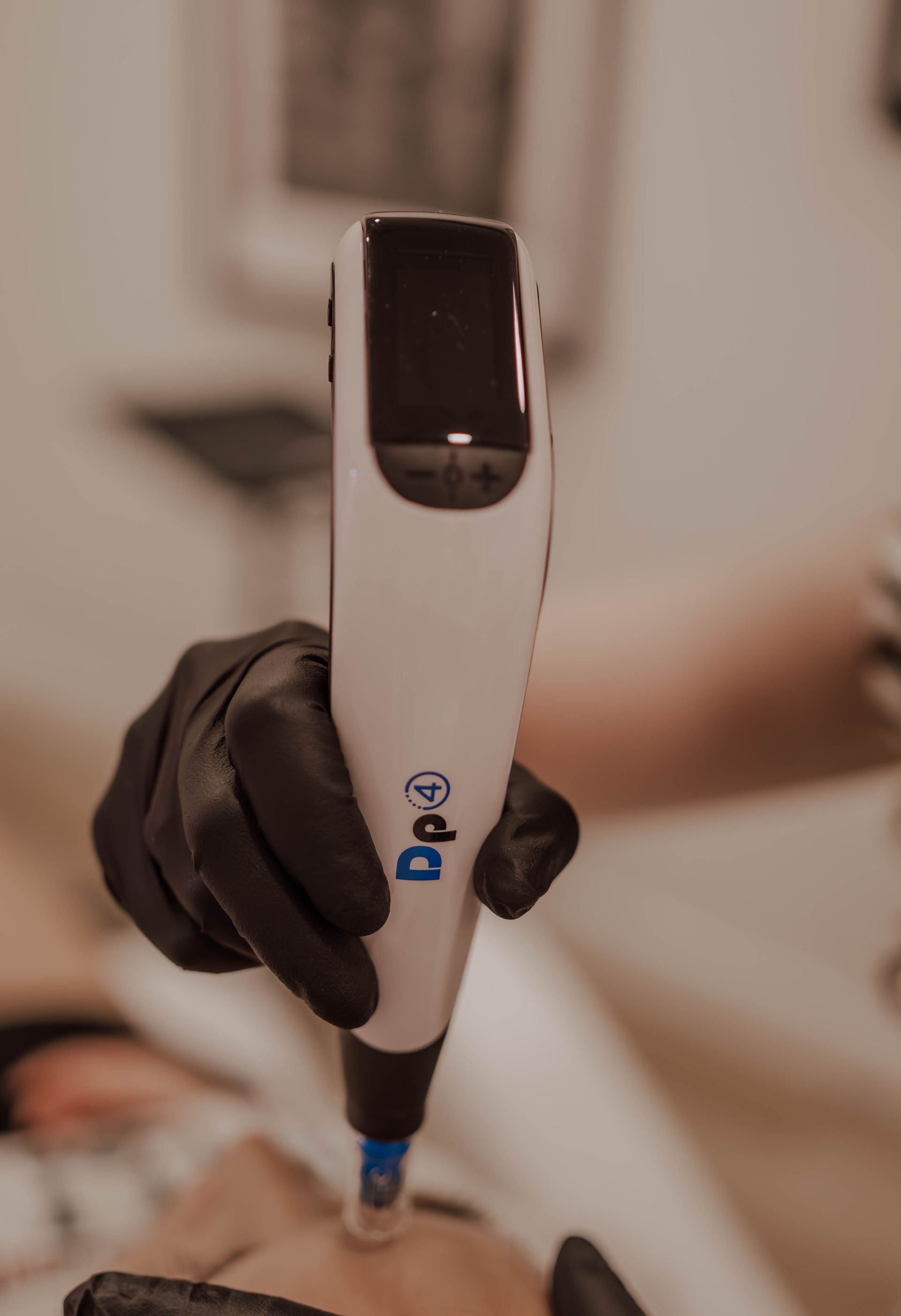 a woman is getting a microneedling treatment
