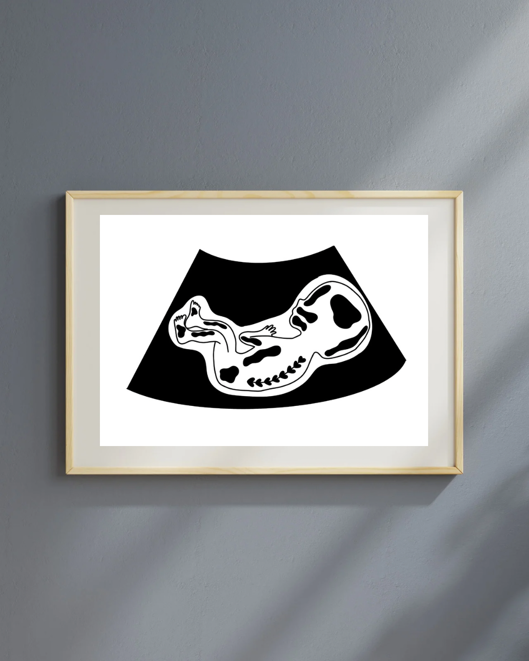 Echo tekening versie 1