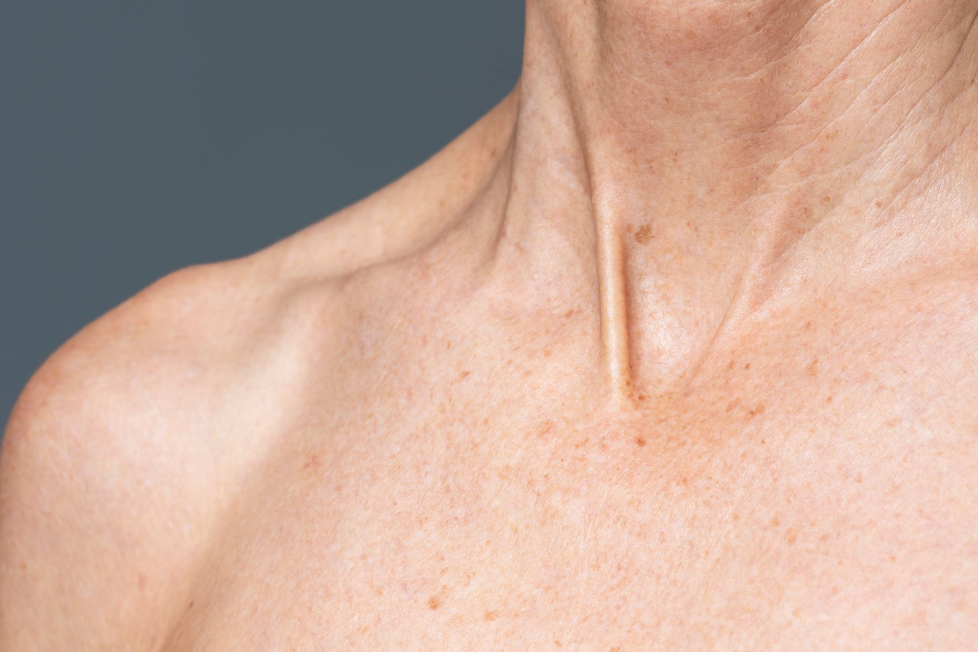 Close-up of a person's bare shoulder and neck against a plain gray background
