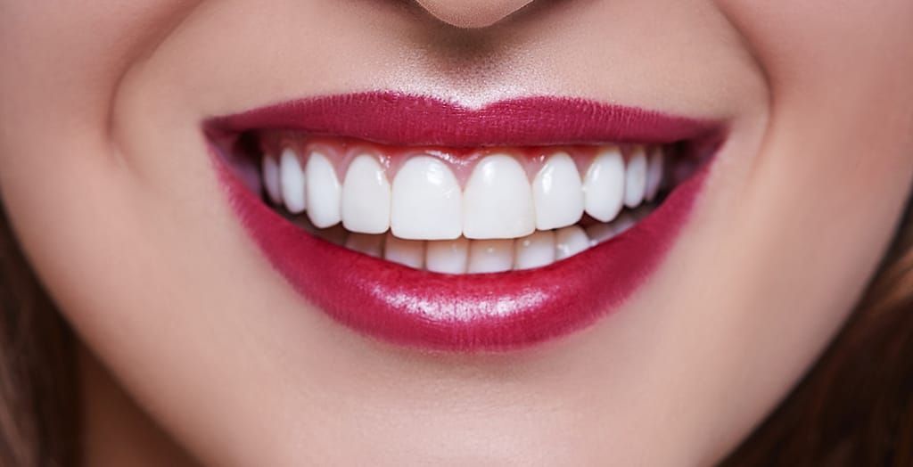 A close up of a woman 's smile with white teeth and red lipstick. A close up of a woman 's smile with white teeth and red lipstick.