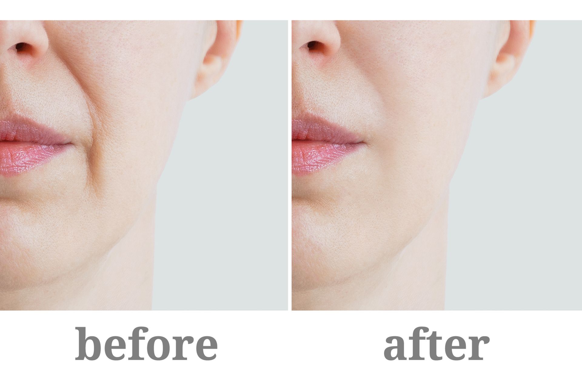 A woman 's face is shown before and after a facial treatment. A woman 's face is shown before and after a facial treatment.